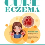 Cure Eczema - PLR eBook Bundle